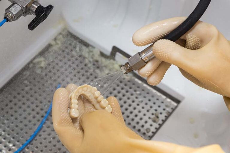 3D printing in dentistry