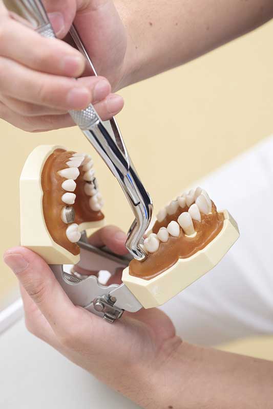 tooth extractions